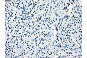 Immunohistochemical staining of paraffin-embedded Ovary tissue using anti-TMEM100mouse monoclonal antibody. (TMEM100 anticorps)