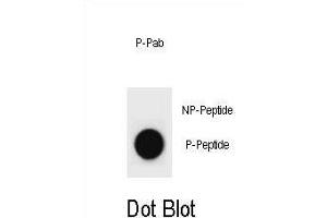 Dot blot analysis of Mouse CCNB2 Antibody (Phospho ) Phospho-specific Pab (ABIN1881162 and ABIN2839967) on nitrocellulose membrane. (Cyclin B2 anticorps  (pThr359))