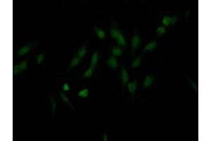 anti-Nucleoporin 98kDa (NUP98) antibody