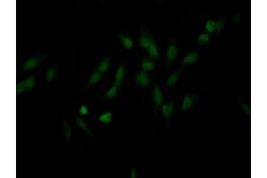 Immunofluorescence staining of Hela Cells with ABIN7127650 at 1:50, counter-stained with DAPI. (Recombinant NUP98 anticorps)