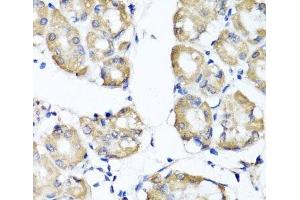 Immunohistochemistry of paraffin-embedded Human stomach using RBP2 Polyclonal Antibody at dilution of 1:100 (40x lens). (RBP2 anticorps)