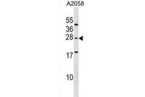 Western Blotting (WB) image for anti-Ependymin Related Protein 1 (Zebrafish) (EPDR1) antibody (ABIN2999325) (EPDR1 anticorps)