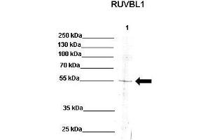 WB Suggested Anti-RUVBL1 Antibody    Positive Control:  Lane 1: 30ug K562 lysate   Primary Antibody Dilution :   1:200  Secondary Antibody :  Anti-rabbit-HRP   Secondry Antibody Dilution :   1:1000  Submitted by:  Sustackova Gabriela