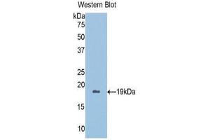 Western Blotting (WB) image for anti-Peroxiredoxin 5 (PRDX5) (AA 1-162) antibody (ABIN1078432) (Peroxiredoxin 5 anticorps  (AA 1-162))