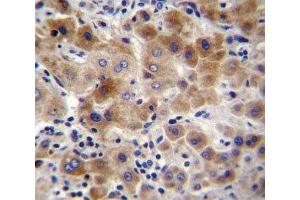 NEU2 antibody immunohistochemistry analysis in formalin fixed and paraffin embedded human liver tissue.
