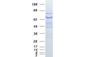Validation with Western Blot