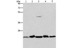 Western Blot analysis of Mouse spleen and Human fetal liver tissue, hela cell and Mouse testis tissue, A431 cell using THOC7 Polyclonal Antibody at dilution of 1:500 (THOC7 anticorps)