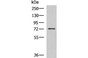 Western blot analysis of K562 cell lysate using GUSB Polyclonal Antibody at dilution of 1:800 (Glucuronidase beta anticorps)