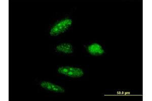 Immunofluorescence of purified MaxPab antibody to RTCD1 on HeLa cell.