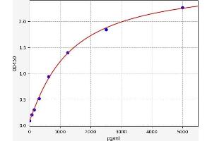 Soluble Interleukin 2a Receptor ELISA Kit