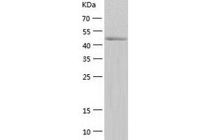 Western Blotting (WB) image for Tyrosyl-tRNA Synthetase 2, Mitochondrial (YARS2) (AA 17-477) protein (His-IF2DI Tag) (ABIN7125570)