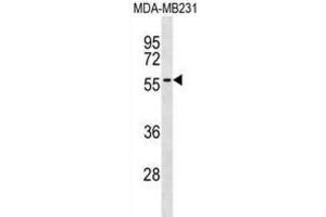 Western Blotting (WB) image for anti-A Kinase (PRKA) Anchor Protein 5 (AKAP5) antibody (ABIN3000745) (AKAP5 anticorps)