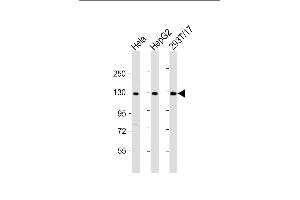 All lanes : Anti-LRIG3 Antibody (N-Term) at 1:2000 dilution Lane 1: Hela whole cell lysate Lane 2: HepG2 whole cell lysate Lane 3: 293T/17 whole cell lysate Lysates/proteins at 20 μg per lane. (LRIG3 anticorps  (AA 23-54))