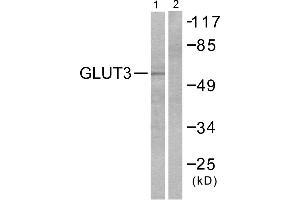 Western blot analysis of extracts from LOVO cells, using GLUT3 antibody (#C0214).