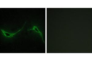 Peptide - +Immunohistochemistry analysis of paraffin-embedded human brain tissue using ADCY7 antibody. (ADCY7 anticorps)