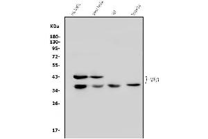 Western blot analysis of GAP43 using anti-GAP43 antibody (ABIN7603111).