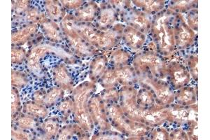 Detection of MCP1 in Rat Kidney Tissue using Polyclonal Antibody to Monocyte Chemotactic Protein 1 (MCP1)