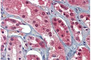 Human Kidney: Formalin-Fixed, Paraffin-Embedded (FFPE)