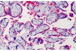 Human Placenta: Formalin-Fixed, Paraffin-Embedded (FFPE) (Syndecan 1 anticorps)