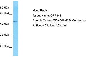 Host: Rabbit Target Name: GPR142 Sample Type: MDA-MB-435s Whole Cell lysates Antibody Dilution: 1. (GPR142 anticorps  (N-Term))