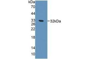 Detection of Recombinant EXO1, Human using Polyclonal Antibody to Exonuclease 1 (EXO1) (Exonuclease 1 anticorps  (AA 1-250))