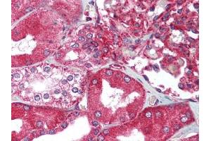 Image no. 1 for anti-X-Box Binding Protein 1 (XBP1) (C-Term) antibody (ABIN302900)