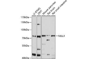 Western blot analysis of extracts of various cell lines, using NELL1 antibody (ABIN6132410, ABIN6144530, ABIN6144531 and ABIN6214585) at 1:1000 dilution. (NELL1 anticorps  (AA 160-420))