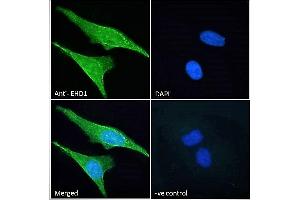 ABIN7013871 Immunofluorescence analysis of paraformaldehyde fixed HeLa cells, permeabilized with 0. (EHD1 anticorps  (N-Term))
