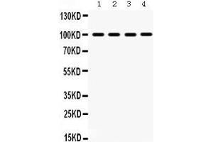 Western Blotting (WB) image for anti-Mitogen-Activated Protein Kinase 6 (MAPK6) (AA 520-721) antibody (ABIN3043611) (MAPK6 anticorps  (AA 520-721))