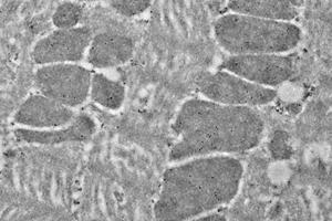 Immunoelectron microscopy analysis of LR white resin-embedded mouse heart using HSP60 (ABIN7074167) at dilution of 1: 50.