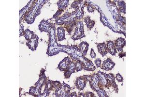 IHC analysis of GRIK1 using anti-GRIK1 antibody (ABIN3042430). (GRIK1 anticorps  (AA 271-450))