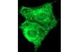 Image no. 3 for anti-Fetal and Adult Testis Expressed 1 (FATE1) antibody (ABIN1498224) (FATE1 anticorps)