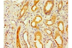 Immunohistochemistry of paraffin-embedded human kidney tissue using ABIN7153663 at dilution of 1:100 (Non-Syndromic Hearing Impairment Protein 5 (GSDME) (AA 1-260) anticorps)