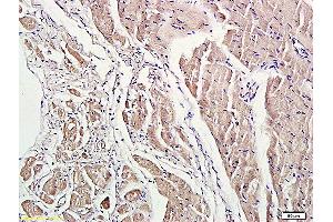 Formalin-fixed and paraffin embedded rat heart labeled with Anti-ROCK1 Polyclonal Antibody, Unconjugated (ABIN738636) at 1:200 followed by conjugation to the secondary antibody and DAB staining. (ROCK1 anticorps  (AA 1001-1200))