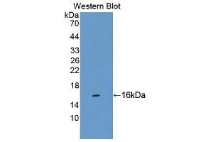 Detection of Recombinant CBY1, Human using Polyclonal Antibody to Chibby Homolog 1 (CBY1) (CBY1/PGEA1 anticorps  (AA 12-115))