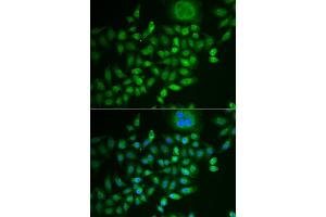 Immunofluorescence analysis of MCF-7 cells using SCG2 antibody (ABIN5973825). (SCG2 anticorps)