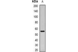 Western blot analysis of Dopamine Receptor D5 expression in mouse brain (A) whole cell lysates. (DRD5 anticorps)