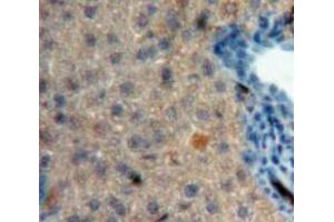 IHC-P analysis of Liver tissue, with DAB staining. (CRH anticorps  (AA 40-195))