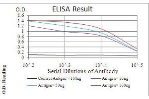 Black line: Control Antigen (100 ng), Purple line: Antigen(10 ng), Blue line: Antigen (50 ng), Red line: Antigen (100 ng), (TERT anticorps  (AA 1029-1132))