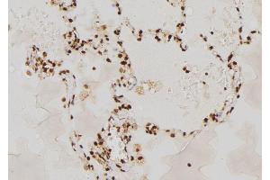 ABIN6277666 at 1/100 staining Human lung tissue by IHC-P. (RAG2 anticorps  (N-Term))