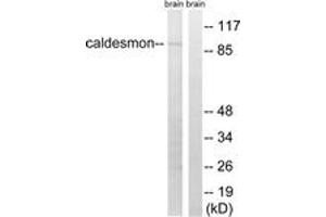 Western blot analysis of extracts from mouse brain cells, using Caldesmon (Ab-759) Antibody. (Caldesmon anticorps  (AA 725-774))