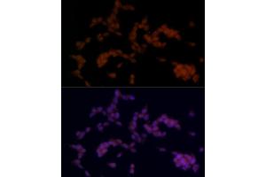 Immunofluorescence analysis of SH-SY5Y cells using SOX11 Rabbit pAb (ABIN7270569) at dilution of 1:100 (40x lens).