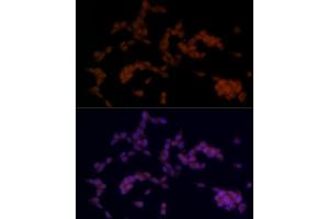 Immunofluorescence analysis of SH-SY5Y cells using SOX11 Rabbit pAb (ABIN7270569) at dilution of 1:100 (40x lens). (SOX11 anticorps)