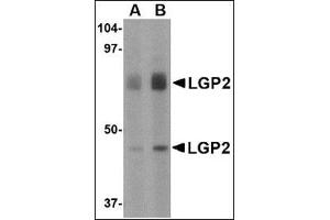 Western blot analysis of LGP2 in rat kidney tissue lysate with this product at (A) 1 and (B) 2 μg/ml. (DHX58 anticorps  (Center))