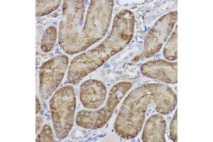 Immunohistochemistry of paraffin-embedded rat kidney using FBP1 Rabbit mAb (ABIN7267269) at dilution of 1:100 (40x lens). (FBP1 anticorps)