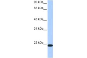 Western Blotting (WB) image for anti-Transmembrane Emp24 Protein Transport Domain Containing 4 (TMED4) antibody (ABIN2462360)