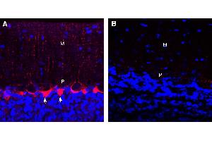 Expression of GABA Transporter 1 in rat cerebellum.