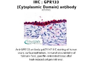 Image no. 1 for anti-G Protein-Coupled Receptor 133 (GPR133) (3rd Cytoplasmic Domain) antibody (ABIN1734933) (G Protein-Coupled Receptor 133 anticorps  (3rd Cytoplasmic Domain))