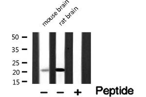Western blot analysis of CIB2 Antibody expression in Various tissues lysates.