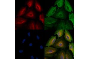 ABIN6257904 and ABIN6274822 staining  cells by IF/ICC.